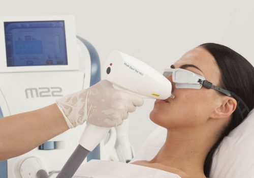 Phototherapy procedure for acne treatment at the medical center.